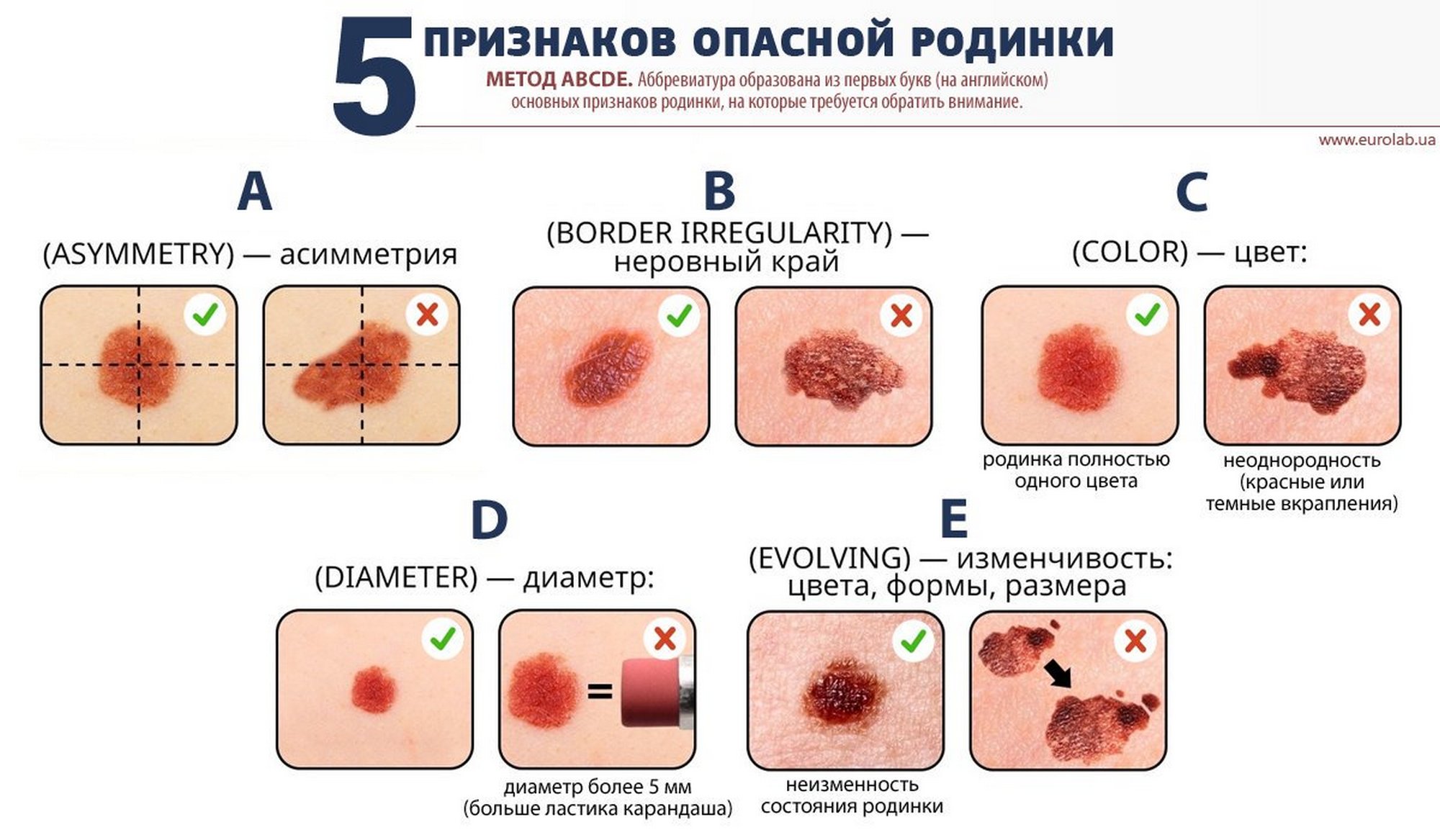 23 мая 2019 года - День профилактики меланомы